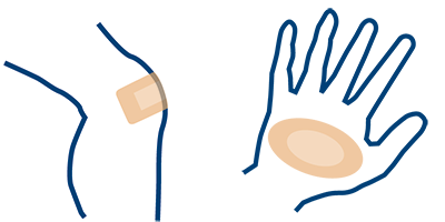 silwo-siliconen-schuimverband 1